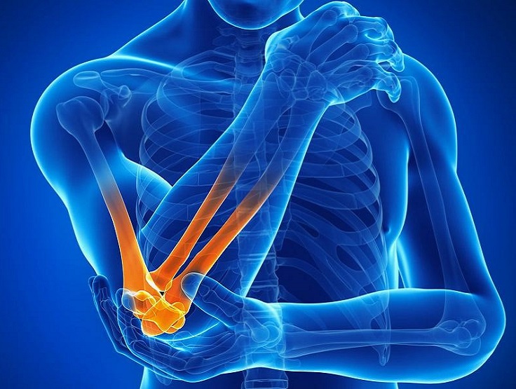 kliničko državno liječenje artroze bol u zglobovima natečene ruke